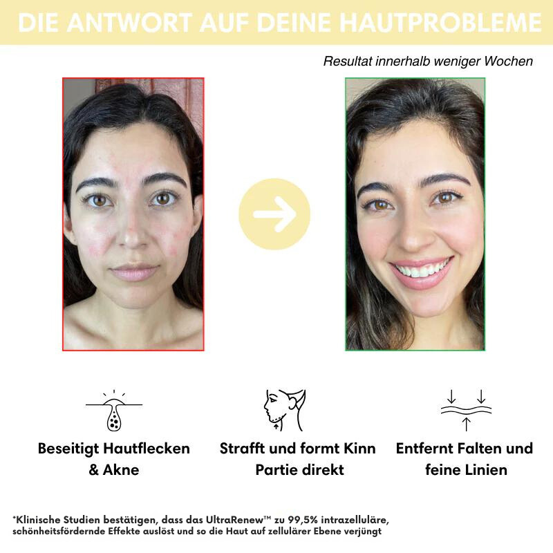 70% Rabatt + Kostenloser Versand | UltraRenew™ - Jugendliches Aussehen in nur 10 Minuten!